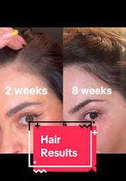 Youth Juice Scalp Treatment