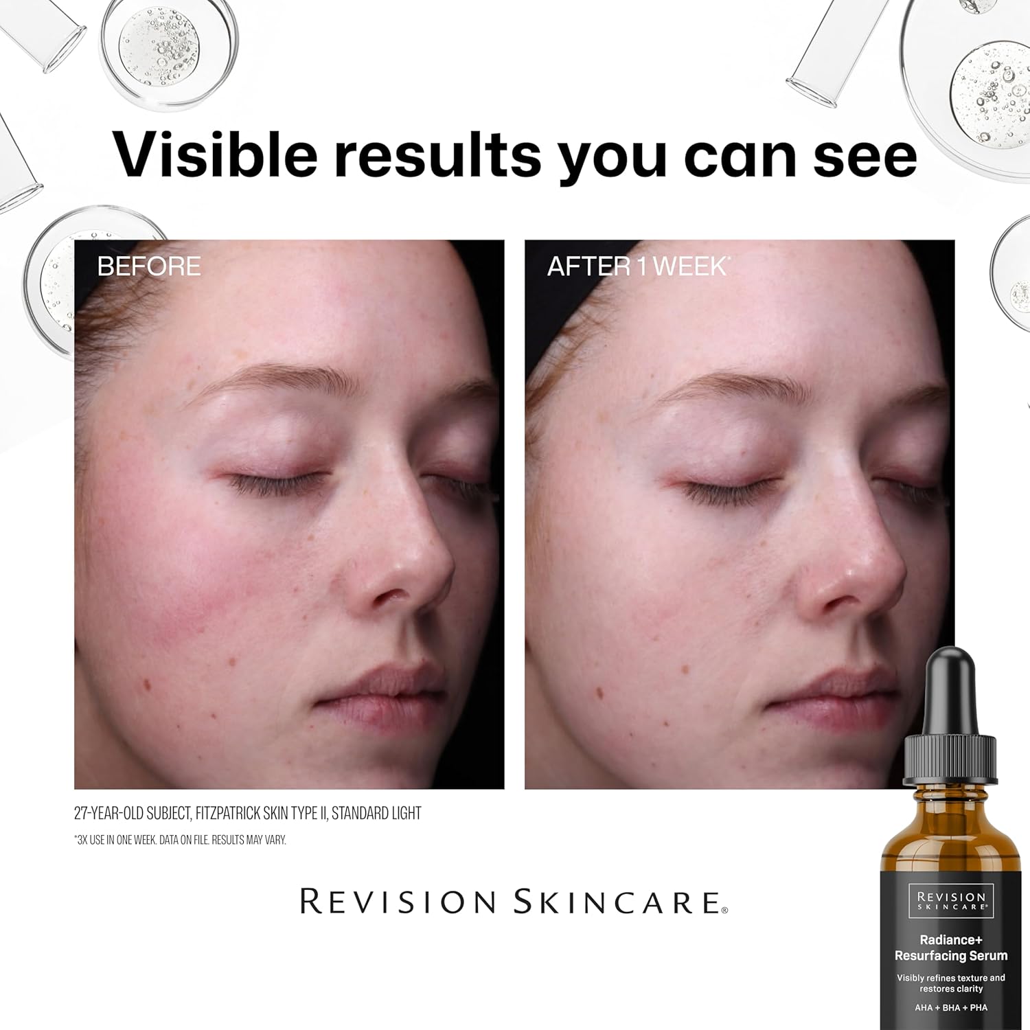 Radiance+ Resurfacing Serum