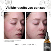 Radiance+ Resurfacing Serum