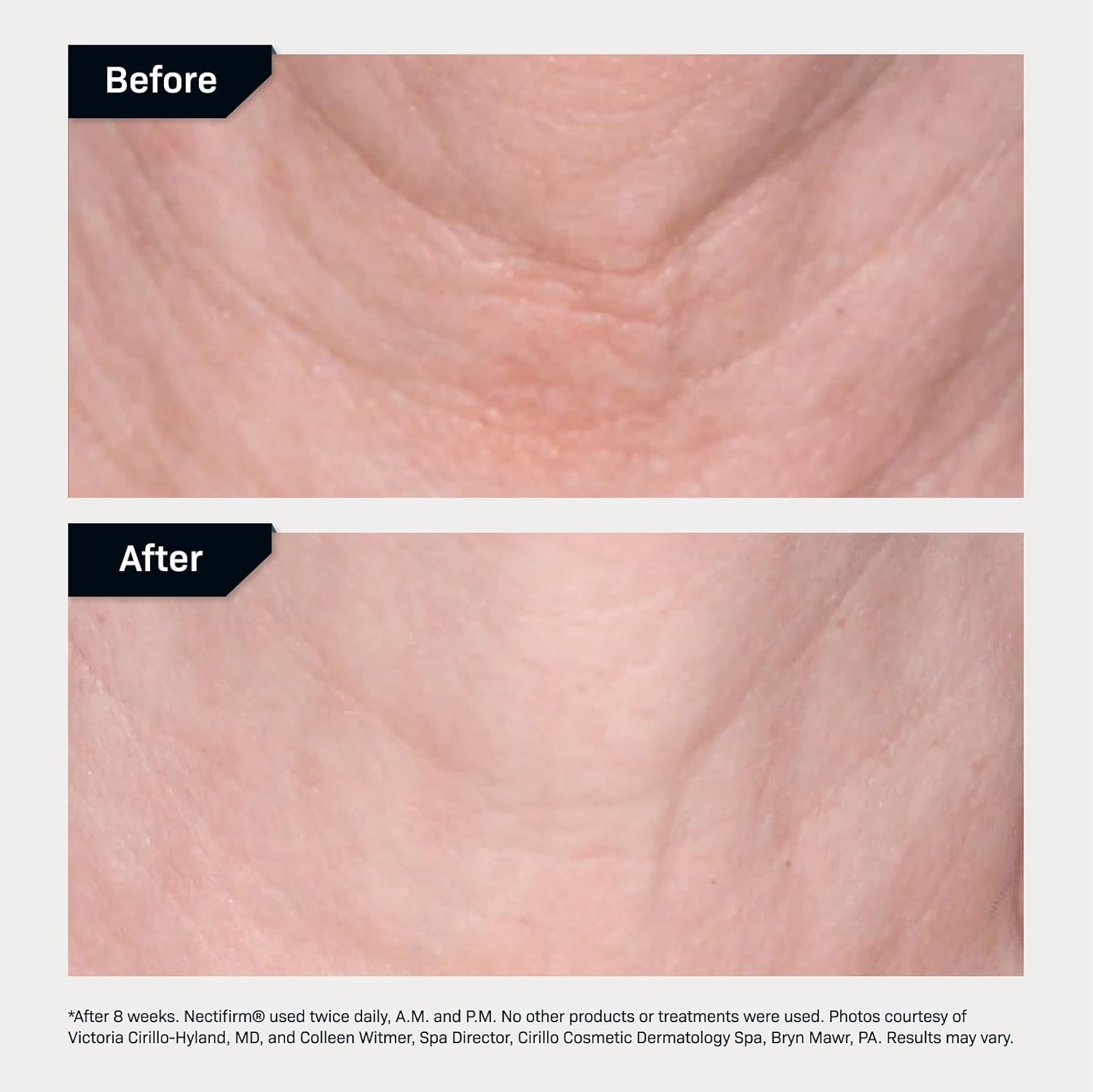 Revision Skincare Nectifirm - 1.7 fl oz