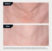 Revision Skincare Nectifirm - 1.7 fl oz