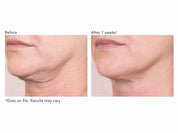 Revision Skincare Nectifirm - 1.7 fl oz