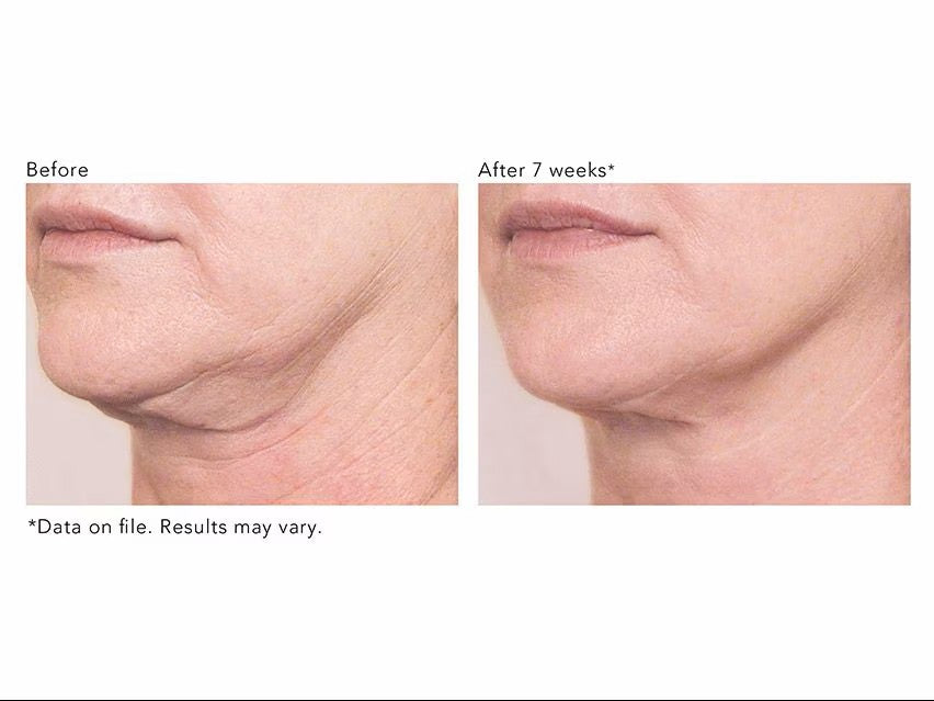 Revision Skincare Nectifirm - 1.7 fl oz