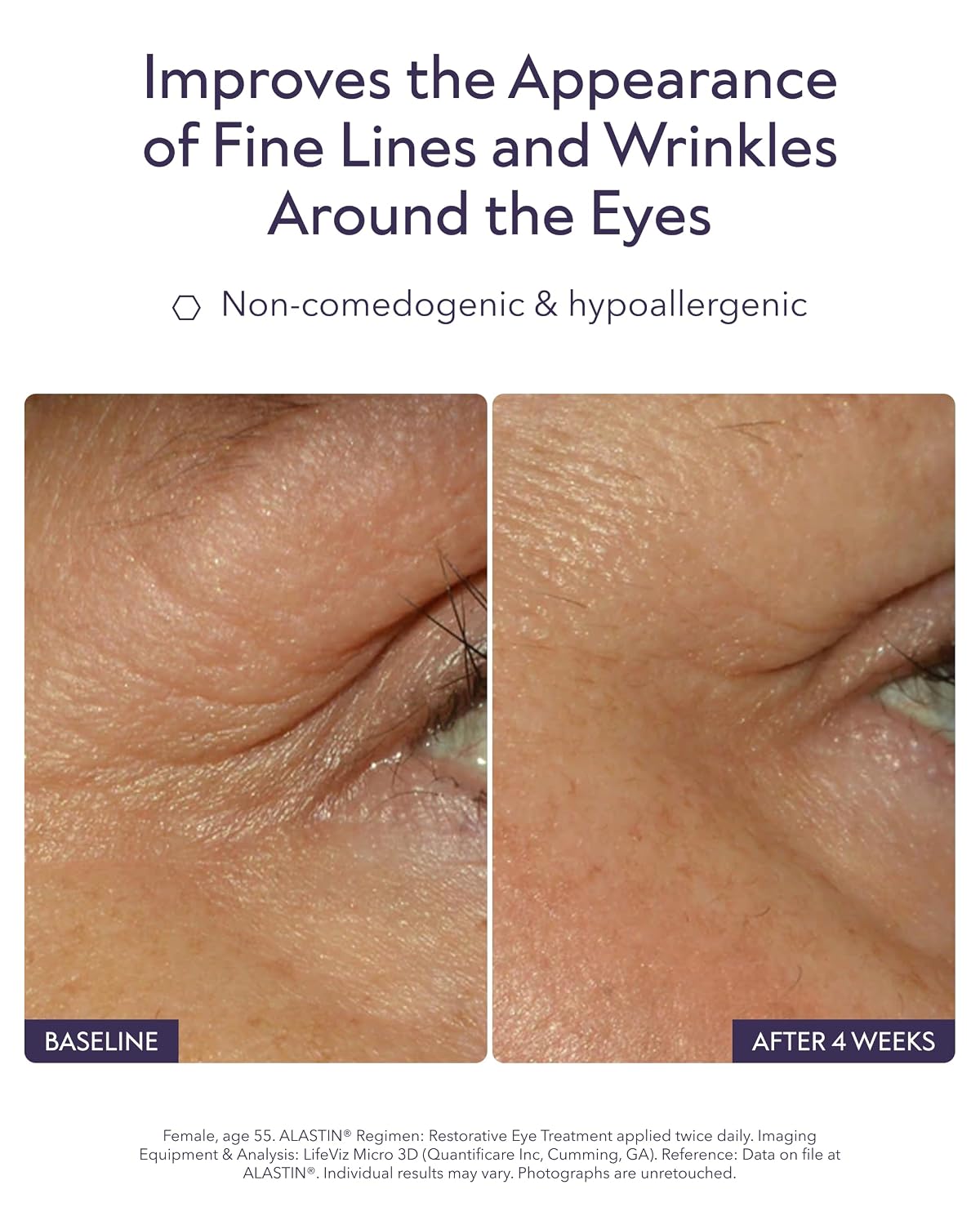 Restorative Eye Complex with TriHex Technology