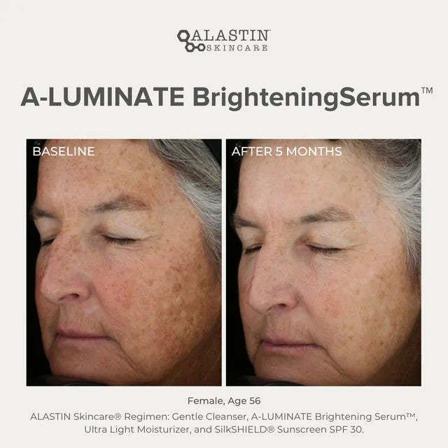 A-Luminate Brightening Serum 0.5