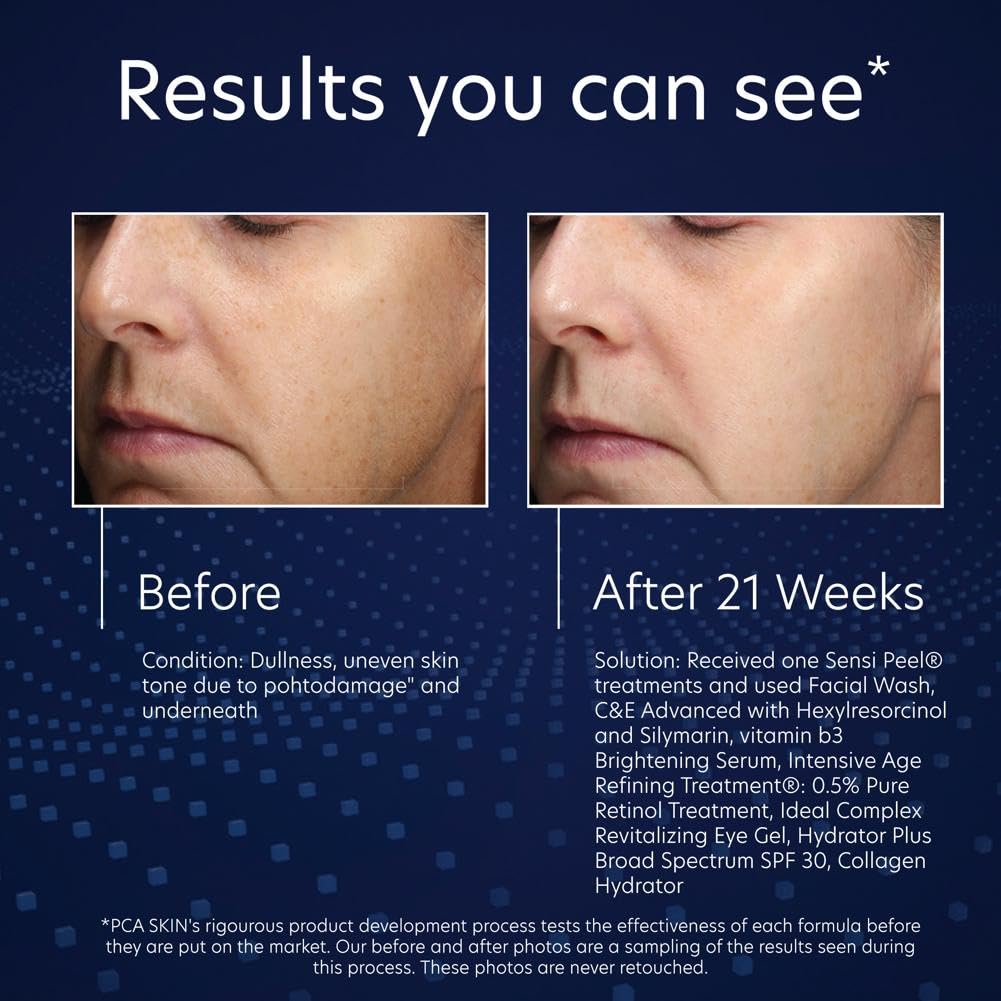 PCA Vitamin B3 Brightening Serum
