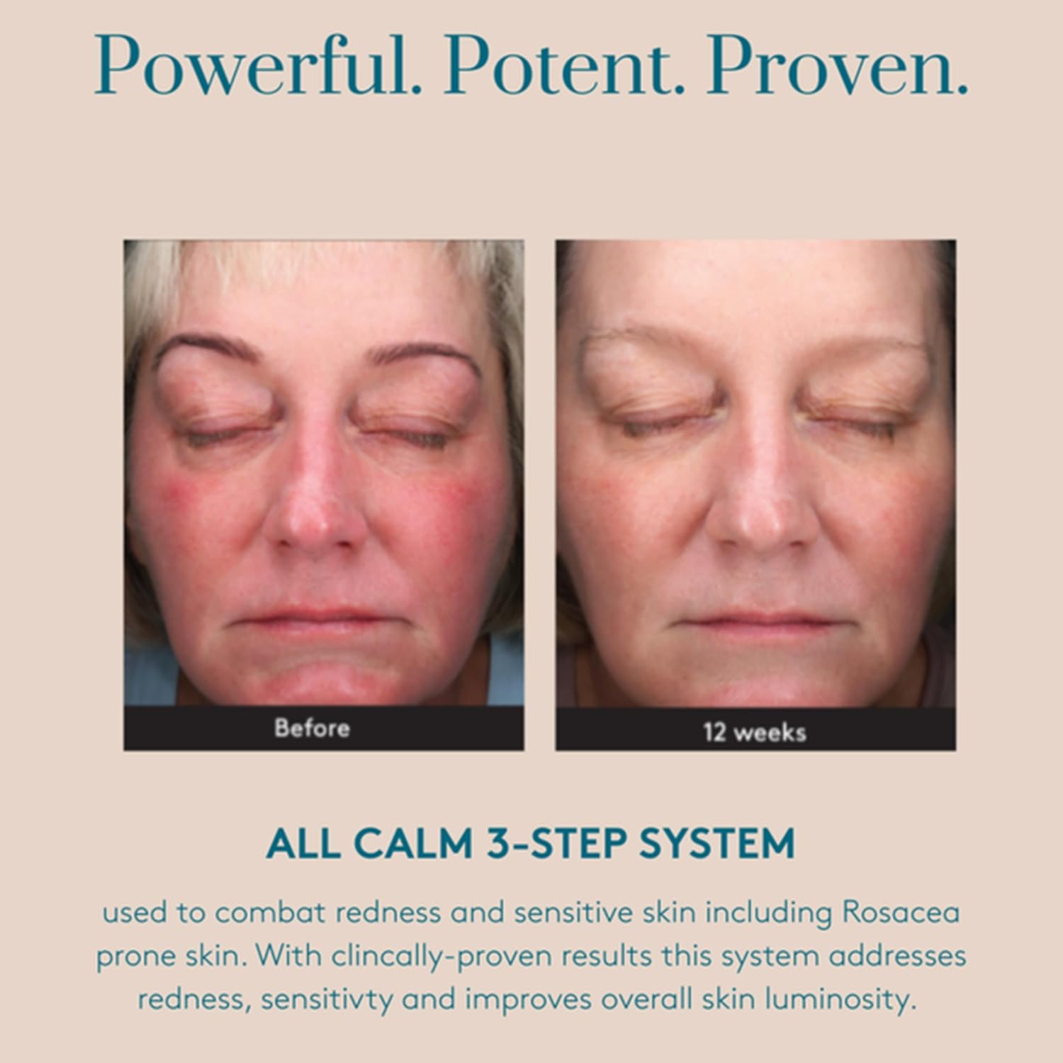 All Calm Multi-correction Serum