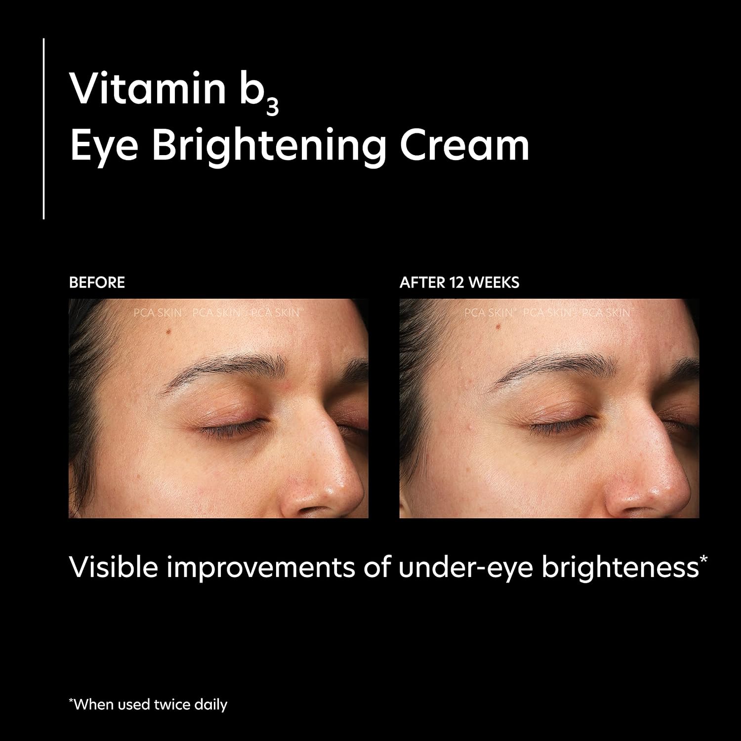 PCA Vitamin B3 Eye Brightening Cream