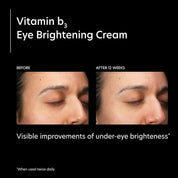 PCA Vitamin B3 Eye Brightening Cream