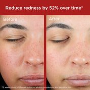 EltaMD UV Skin Recovery Broad Spectrum SPF 50 - Green Tint for Redness