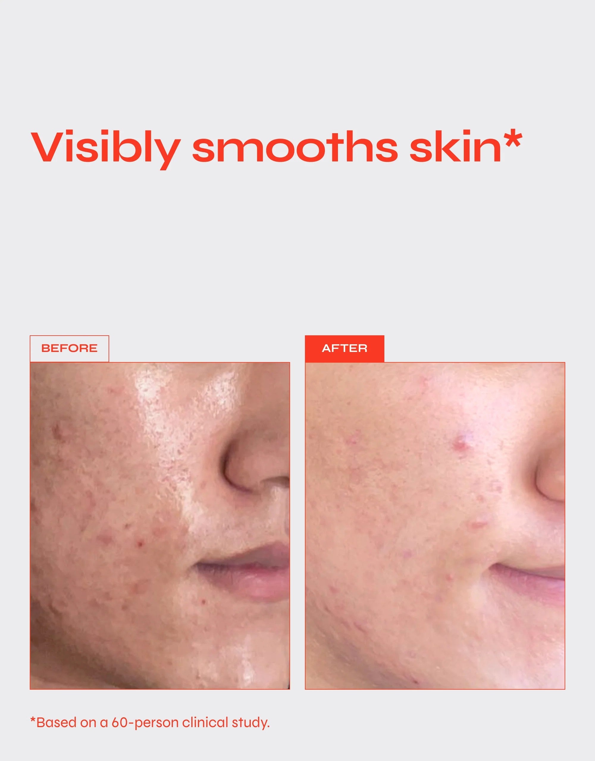 REVERSE - 0.2% Retinol Firming Serum for Fine Lines & Wrinkles