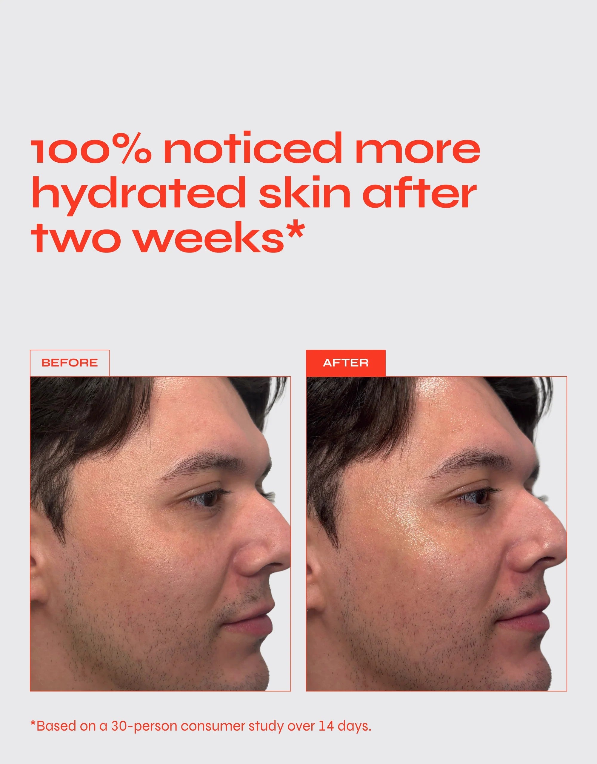 Dew You - Hydrating Hyaluronic Acid Gel Serum