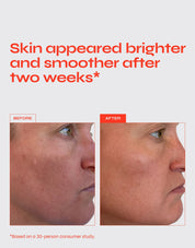 The Buzz - Brightening Exfoliating Facial Treatment with AHA & BHA