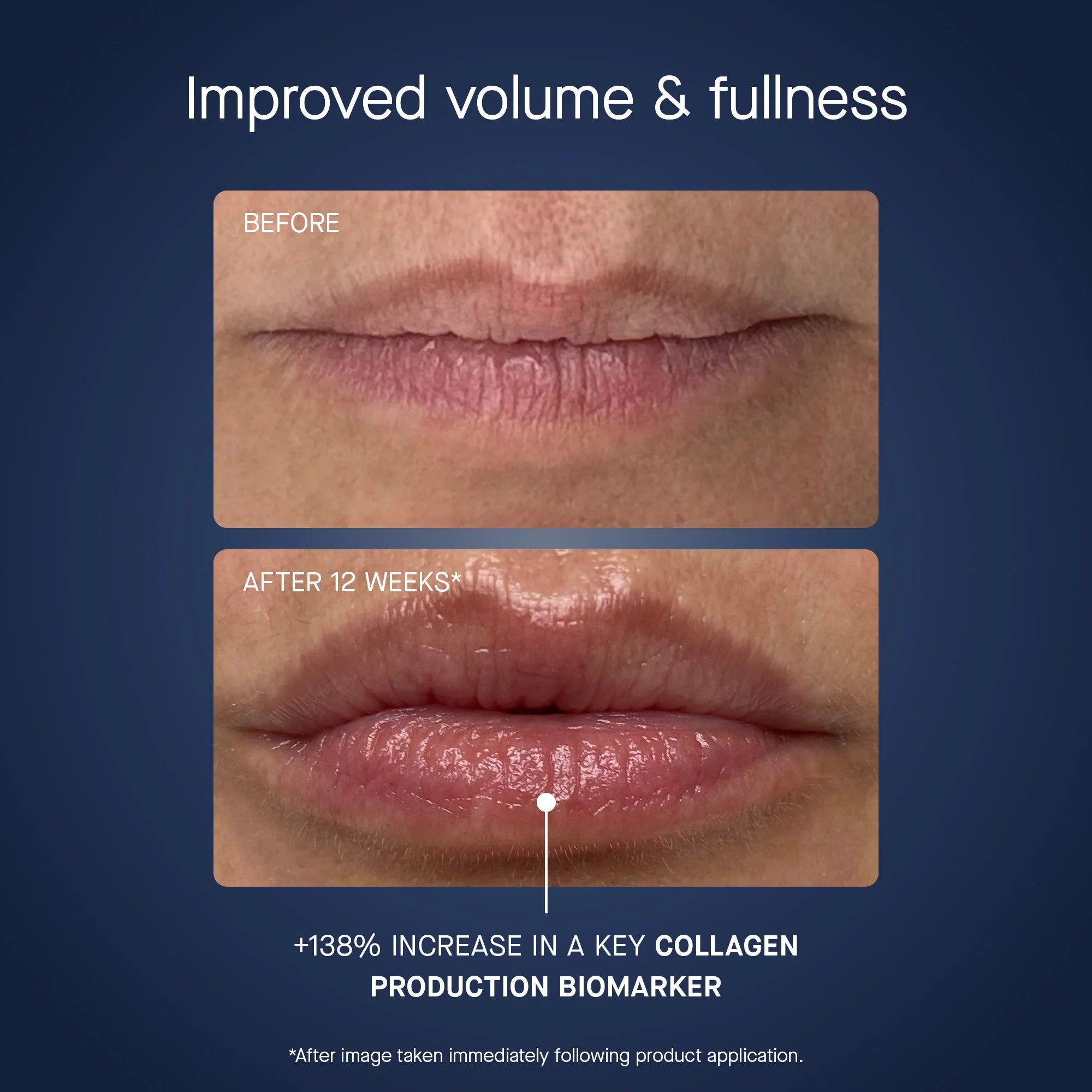 OS-01 LIP RESTORE MASK