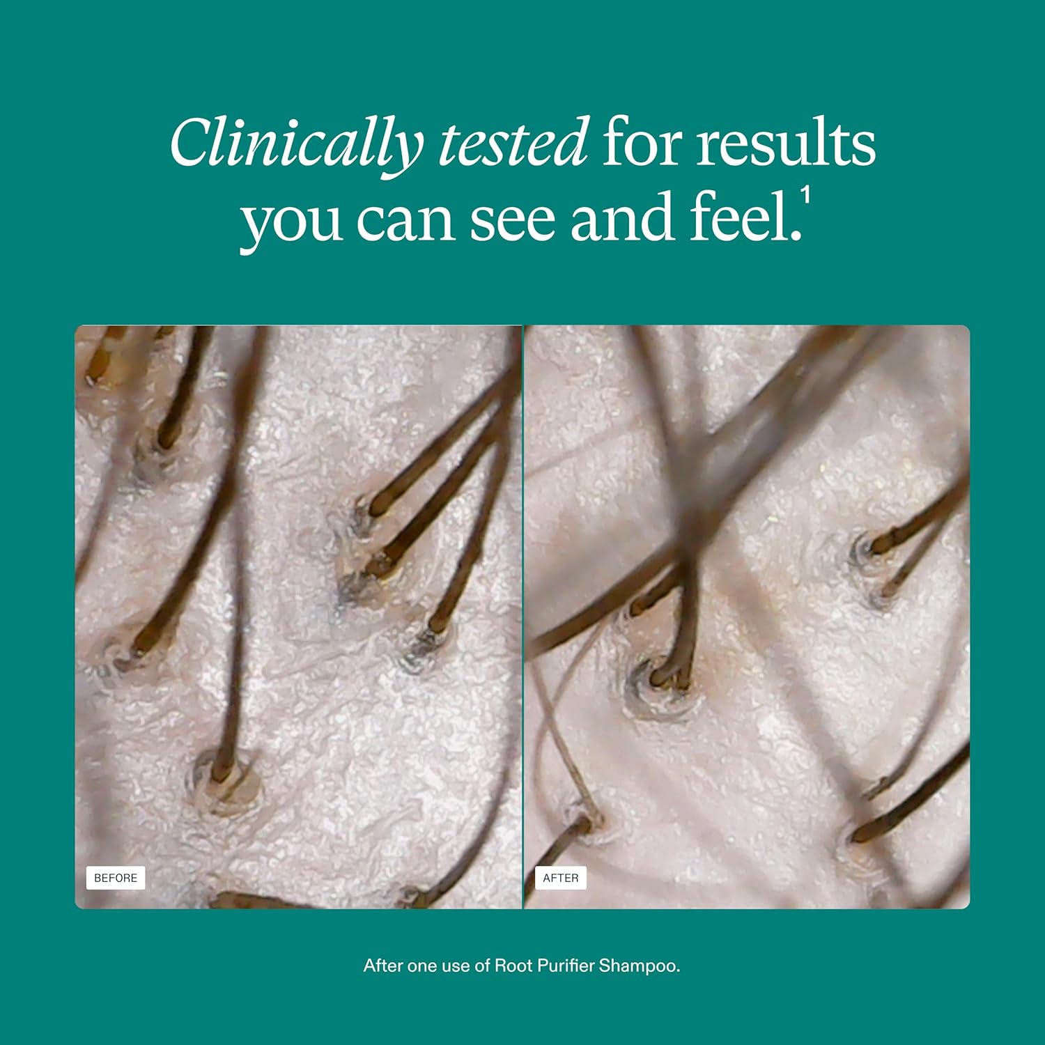 Nutrafol Root Purifier Shampoo