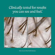 Nutrafol Root Purifier Shampoo