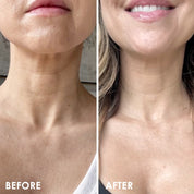 Neck Firming Lift Professional Strength