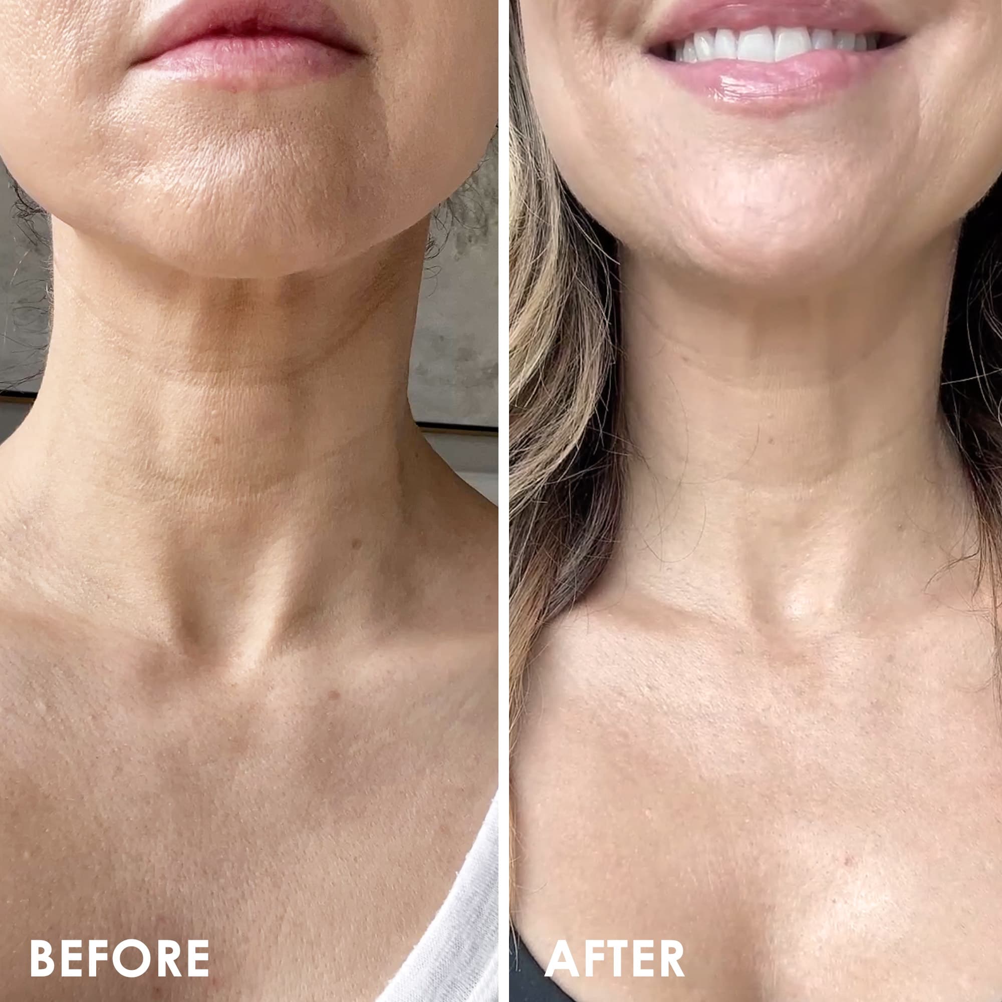 Neck Firming Lift Professional Strength