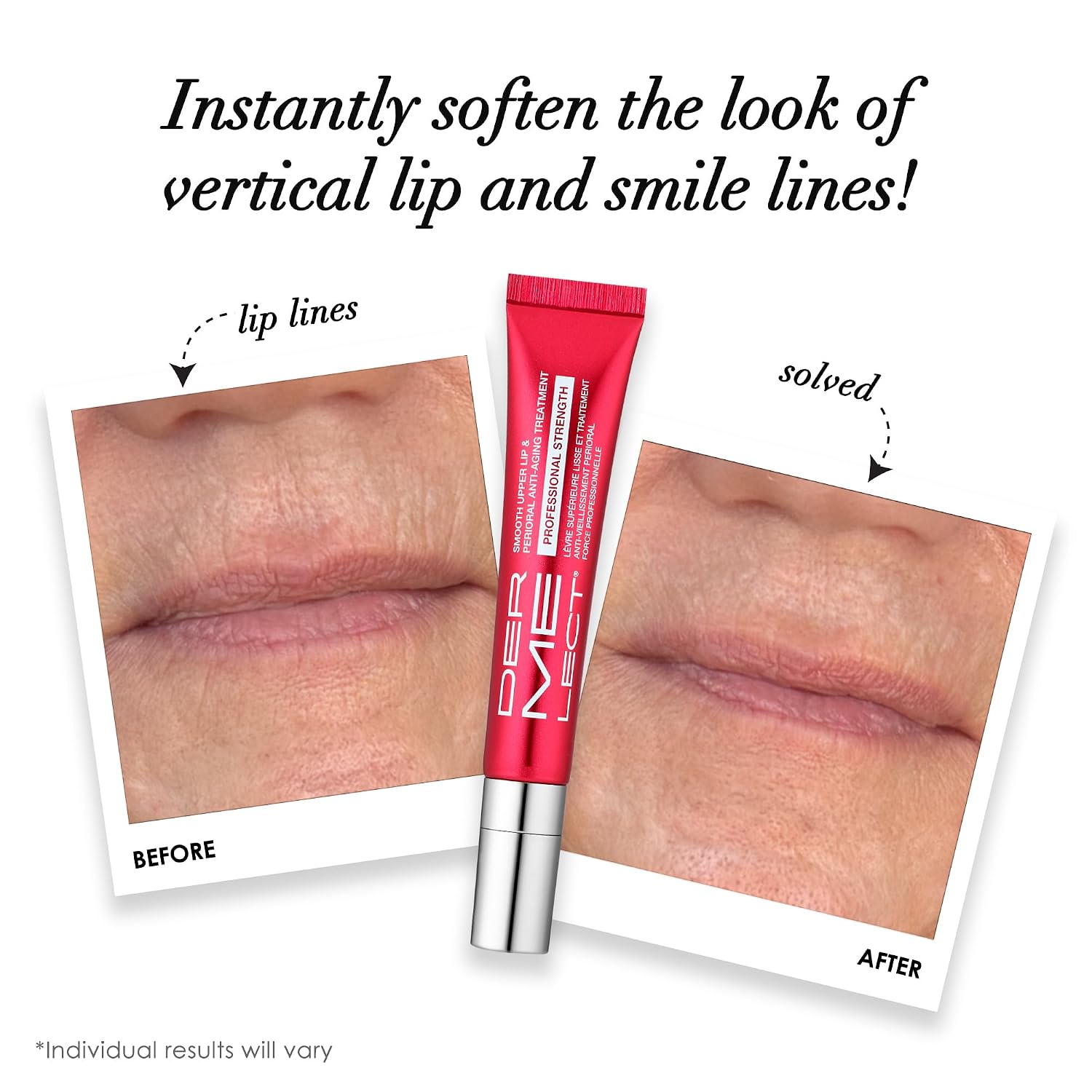 SMOOTH UPPER LIP Perioral Anti-Aging Treatment PROFESSIONAL STRENGTH