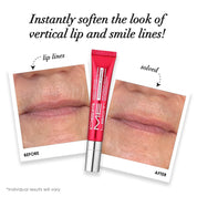 SMOOTH UPPER LIP Perioral Anti-Aging Treatment PROFESSIONAL STRENGTH