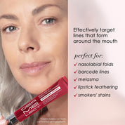 SMOOTH UPPER LIP Perioral Anti-Aging Treatment PROFESSIONAL STRENGTH