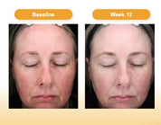 C-Radical Defense Antioxidant Serum 1.0