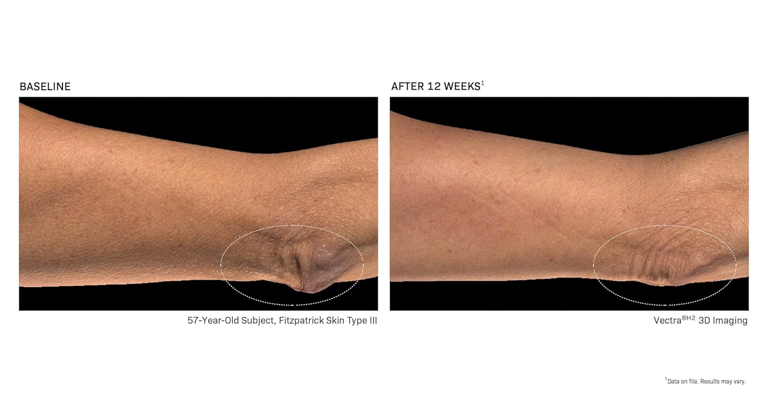 Bodifirm Body Contouring Lotion