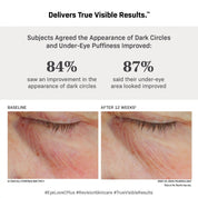 Revision Skincare C+ Brightening Eye Complex - 0.5 fl oz