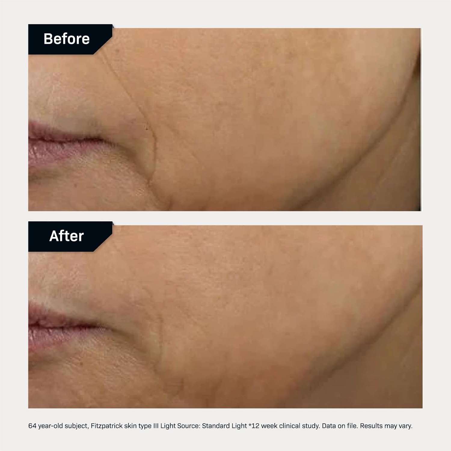 Revision Skincare D·E·J Face Cream - 0.5 fl oz