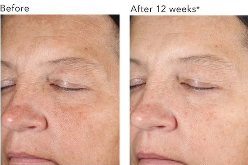 Revision Skincare D·E·J Night Face Cream - 0.5 fl oz