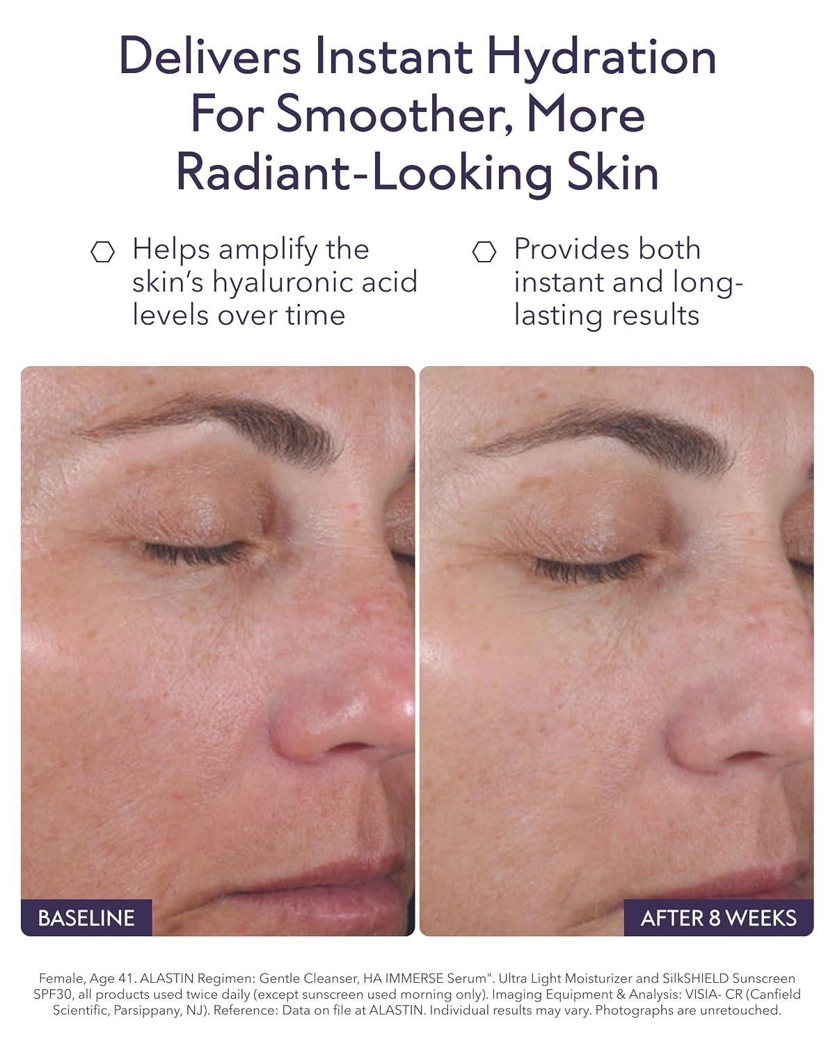 HA (Hyaluronic Acid) IMMERSE Serum