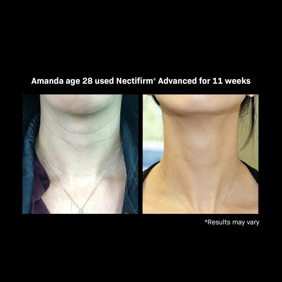 Revision Skincare Nectifirm ADVANCED