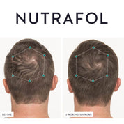 Nutrafol Men Over 50 3 MONTH
