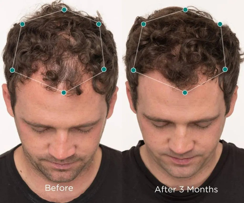 Nutrafol Men Over 50 3 MONTH