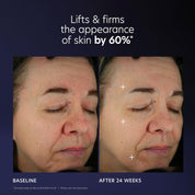 PCA Pro-Max Age Renewal