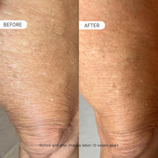 Body Peptide Skin Moisturizer